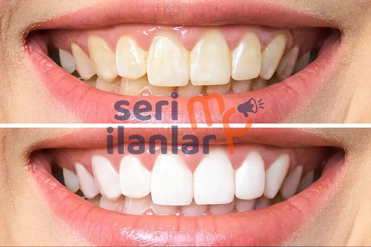 Bakırköy Dental